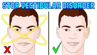 The 4 minute natural method for vestibular disorder  migraines amp imbalance [upl. by Ahsote]