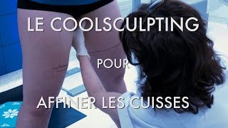 Le COOLSCULPTING pour affiner les cuisses  La Cryolipolyse au Centre Marceau Paris [upl. by Okramed126]