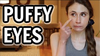 How to get rid of puffy eyes Dr Dray [upl. by Mariejeanne]