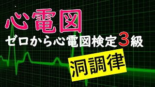 心電図 ゼロから心電図検定3級【洞調律】 [upl. by Ordway945]