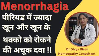 Menorrhagia Menorrhagia treatment Menorrhagia homoeopathy treatment heavy bleeding during periods [upl. by Hesta]