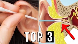 TOP 3  Meilleur Kit Nettoyage Oreille de 2022 [upl. by Berkman774]