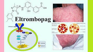 eltrombopag [upl. by Kcirddehs]