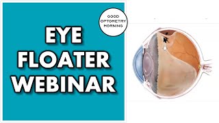 FLOATERS IN MY EYES youtube eye doctor webinar on eye flashes amp floaters [upl. by Anidan783]