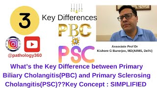 Primary Sclerosing Cholangitis PSC versus Primary Biliary Cholangitis PBC  medicine medicos [upl. by Eninnaj890]