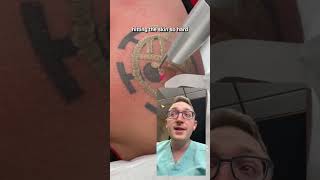 How Does Laser Tattoo Removal Work [upl. by Yevrah]