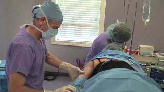 Laser Liposuction Surgery Louisville KY  Dr Garrett M Crabtree [upl. by Nichola]