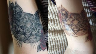 RealTime Laser Tattoo Removal for Face Tattoos [upl. by Namyaw65]