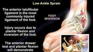 Foot and Ankle Injuries and fractures  Everything You Need To Know  Dr Nabil Ebraheim [upl. by Cooperman]