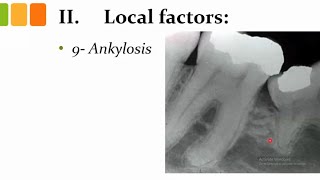 orthodontics L13 etiology of malocclusion 4 [upl. by Ainevul]