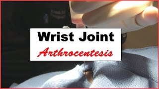 Wrist Joint Arthrocentesis Procedure [upl. by Brownley]