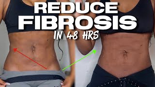 HOW TO Compress and wear foams properly  At home massages  Reduce Fibrosis  Swelling after Lipo [upl. by Anerol661]