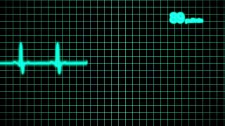 Cardiogram 1080p [upl. by Wheaton]