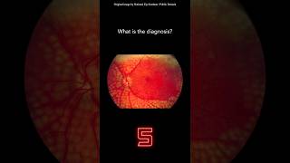 Fundoscopy Question 12 [upl. by Dann]