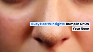 Bump in or on Your Nose Common Causes and When to Seek Medical Care  BuoyHealthcom [upl. by Wakefield]