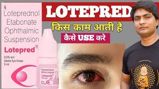 lotepred eye drop  lotepred eye drops  lotepred eye drops uses in hindi  lotepred eye drops uses [upl. by Alam211]