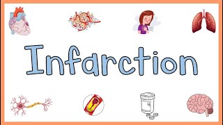 Infarction  Causes Types Morphology amp Factors influencing development of infarction [upl. by Ahseile]