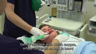 Paediatric Anaesthetics Chapter 3  Intubation rsi child [upl. by Salomo]