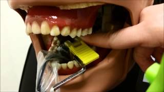 Mandibular Posterior Periapical Technique [upl. by Atnahs]