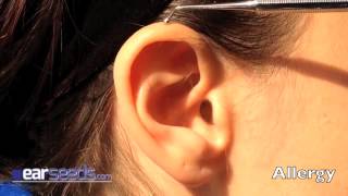 Allergy Auriculotherapy Ear Point [upl. by Sirod]