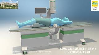 Extracorporeal Shock Wave Lithotripsy ESWL – CIMS Hospital [upl. by Leunamnauj816]