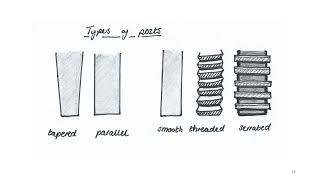 post endodontic restorations [upl. by Im]