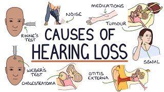 Understanding the Causes of Hearing Loss [upl. by Graubert]