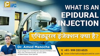 Epidural Injection amp Nerve Root Block for Sciatica Pain Management  Dr Amod Manocha [upl. by Nnaeoj]