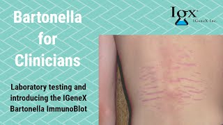 Introducing IGeneX Bartonella ImmunoBlots [upl. by Aniv]