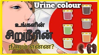 Urine colour change reason tamil  Kidney failure symptoms in tamil  urine colour changes tamil [upl. by Nizam]