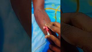 Iv cannula procedure 😍 shorts cannula trending youtubeshorts mbbs doctor nursing love song [upl. by Edsel]