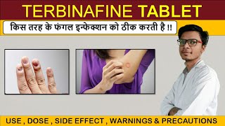 terbinafine tablets ip 250 mg  terbinafine tablets ip 500mg  terbinafine 250 mg [upl. by Acinorev]