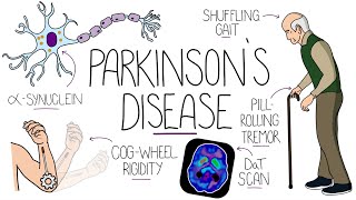 Understanding Parkinsons Disease Including Direct and Indirect Pathways [upl. by Garrek]