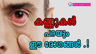 കണ്ണ് നോക്കി രോഗങ്ങൾ തിരിച്ചറിയാം  Eye disease  Ethnic Health Court [upl. by Hakim]