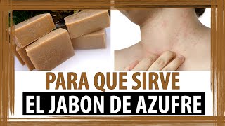 PARA QUE SIRVE EL JABON DE AZUFRE [upl. by Eldoria]