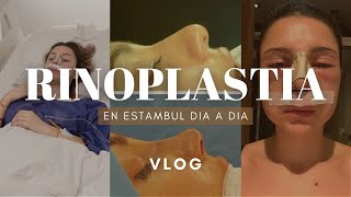 MI RINOPLASTIA EN ESTAMBULTURQUIA experiencia  VLOG DIA A DIA  rhinoplasty experience [upl. by Adnohsed]