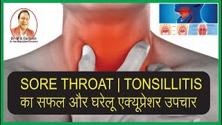 SORE THROAT  TONSILLITIS का सफल और घरेलू एक्यूप्रेशर उपचार । Dr Darbesh [upl. by Narej364]