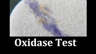 Oxidase test Protocol [upl. by Mmada761]