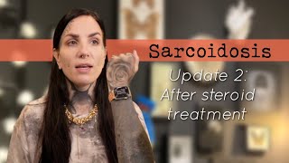 Sarcoidosis update 2 After topical steroid treatment [upl. by Htebazil]