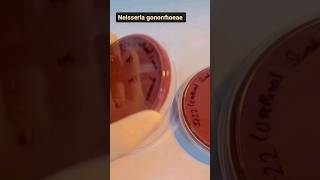 Microbiology lab  Neisseria gonorrhea isolated from a urethral swab microbiology medical mbbs [upl. by Hedve]