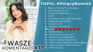 Palący Rumień  Wasze Komentarze71 [upl. by Atokad687]