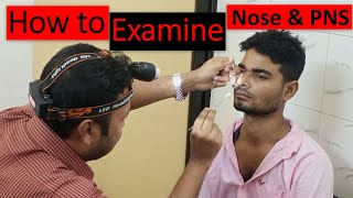 Clinical Examination of Nose amp Paranasal Sinuses Step by Step Demonstration [upl. by Fredrick353]