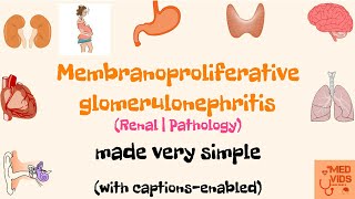 Membranoproliferative glomerulonephritis  MPGN  Renal system  Pathology  Med Vids made simple [upl. by Llertnor938]