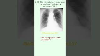 Radiology Buzz 15 radiologychannel007 [upl. by Sert559]