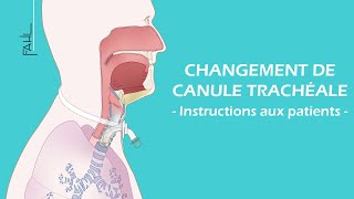 Changement de canule trachéale pour les patients  Animation  Fahl MedizintechnikVertrieb GmbH [upl. by Eniron]