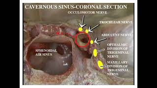 Sphenoid Bone [upl. by Otreblanauj]