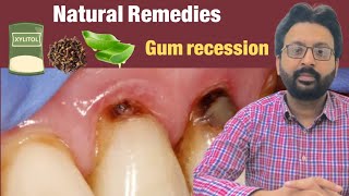 Grow Back Receding Gums Naturally [upl. by Einnhoj]