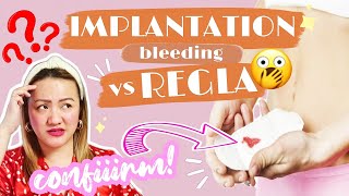 IMPLANTATION BLEEDING VS PERIOD 6 NA PAGKAKAIBA  Nurse Aileen  Tagalog [upl. by Carina]