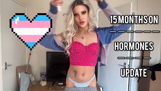 Transgender MTF  15 MONTHS HRT update [upl. by Ognimod]