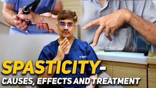 Spasticity Causes Effects and Treatment DrRoopesh Kumar [upl. by Collette]